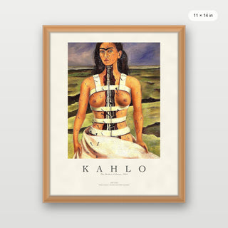 Kahlo - The Broken Column P1