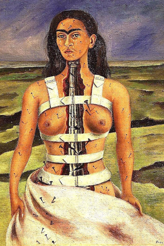 Kahlo - The Broken Column P2
