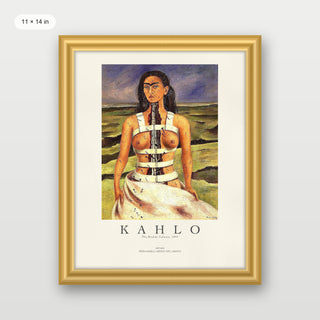 Kahlo - The Broken Column P2